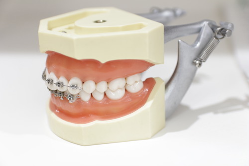 矯正歯科の必要性